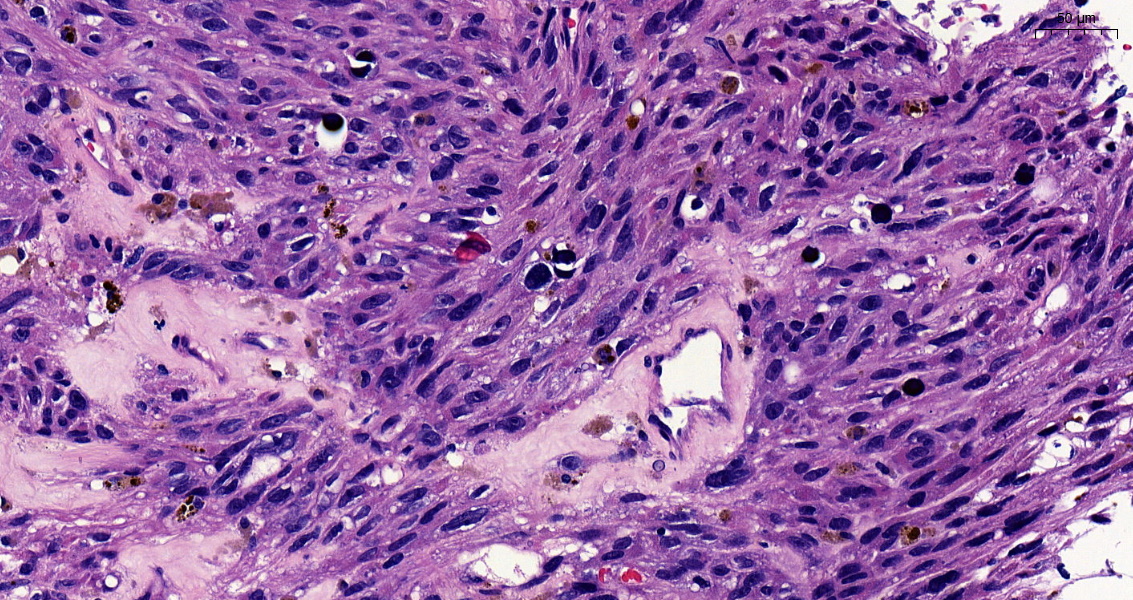 SEAP_IAP's tweet image. Enhorabuena a Cristian Benavides de la Fuente, residente de 3er año del Hospital Universitario Puerta del Mar (Cádiz) por ser el autor de nuestro #CasoDelMes de junio. 

seap.es/web/guest/actu…