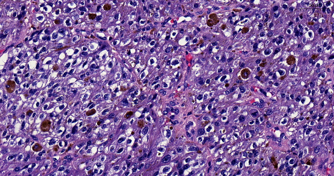 SEAP_IAP's tweet image. Enhorabuena a Cristian Benavides de la Fuente, residente de 3er año del Hospital Universitario Puerta del Mar (Cádiz) por ser el autor de nuestro #CasoDelMes de junio. 

seap.es/web/guest/actu…