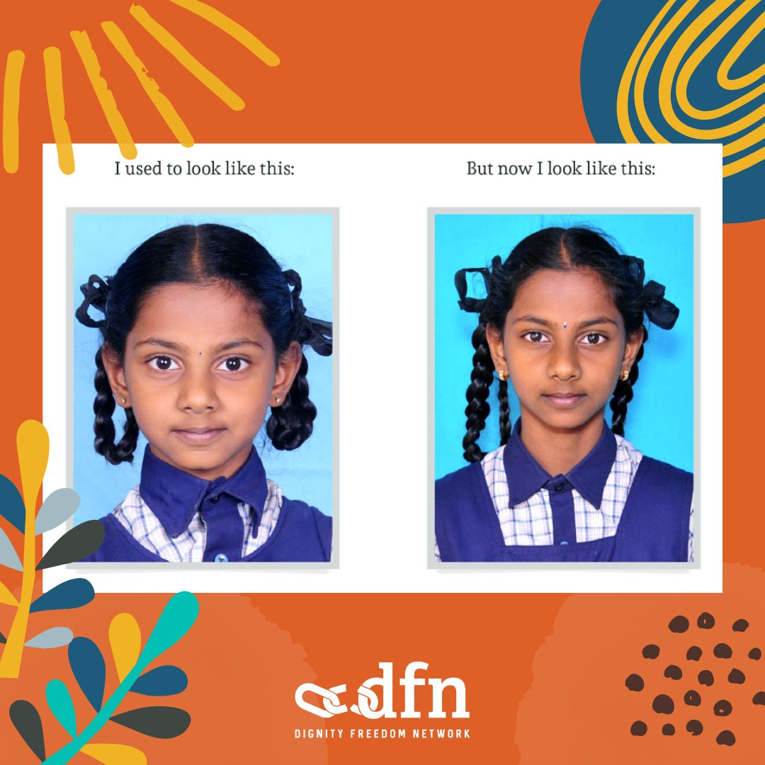 DFN_USA's tweet photo. Prashanti spent the first ten years of her life in an orphanage. 

But because of the help of donors, Prashanti became a part of the DFN community. Prashanti is now 14 years old and thriving! In her words, “I want to be a teacher and help underprivileged orphans, just like me.” https://t.co/ixsEOVX0tk