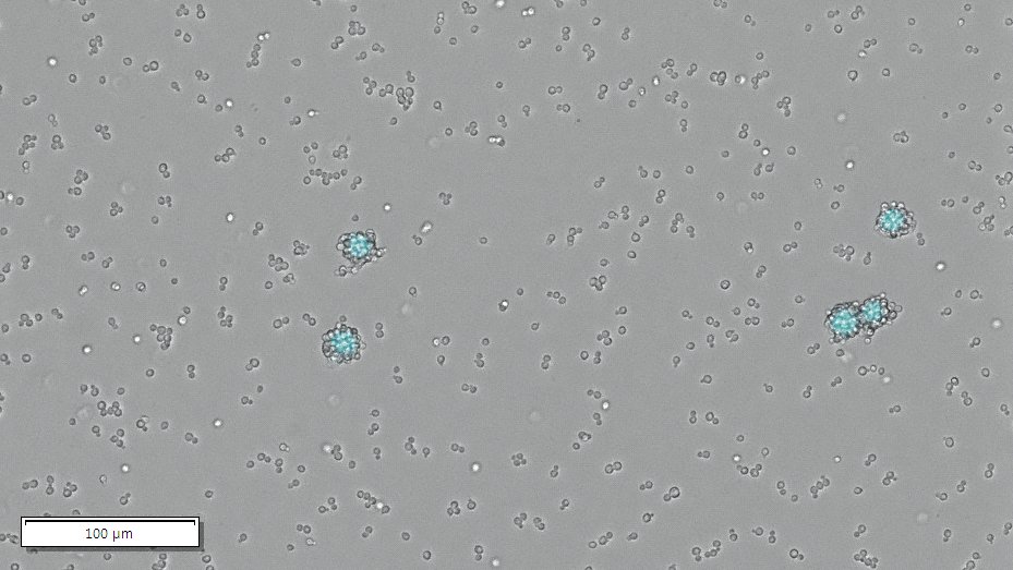 samplinghuman's tweet photo. Living Information Technology in action! Our engineered cells are able to recognize CD138 surface markers on RPMI 8226 #MultipleMyeloma cells (blue) and signal their presence in a sample. #itsLIT https://t.co/NZvcrblyEk