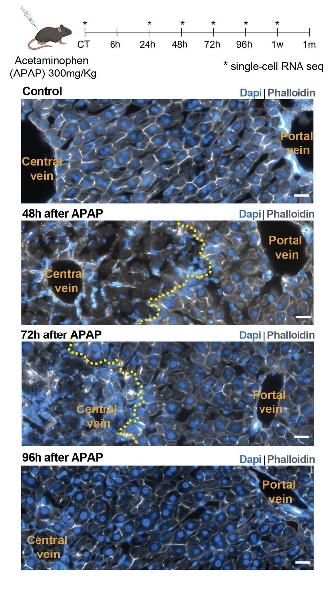 Excited to share our work on liver zonal regeneration by the amazing @ShaniBmo published today in @CellStemCell: sciencedirect.com/science/articl…. Acetaminophen overdose leads to massive death of pericentral hepatocytes, yet complete regeneration within 4 days...