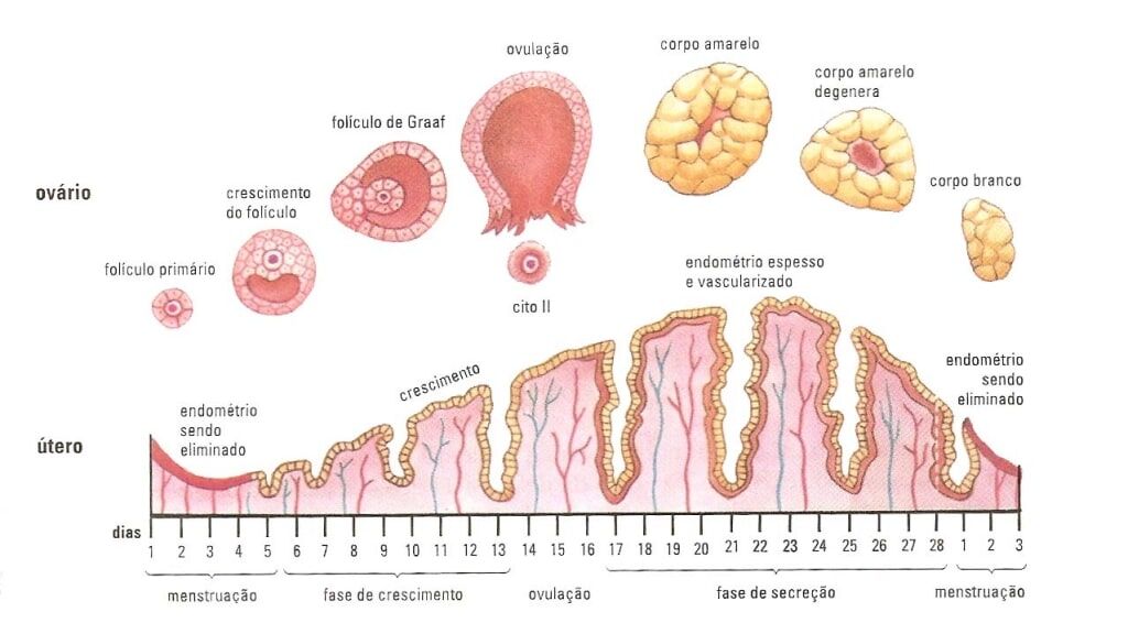 Inflamación en un ovario