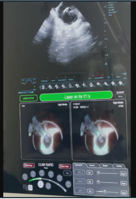 DebbeMcCall's tweet photo. Recorded : Laser Balloon Case - 
@dkenigsberg
 #EPLiveAustin2022 
@DJ_Lakkireddy https://t.co/vuWNfpaOdH