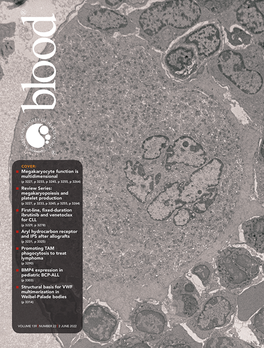 The newest issue of Blood is now available featuring a new review series on megakaryopoiesis and platelet production loom.ly/aom8sOU #hematology