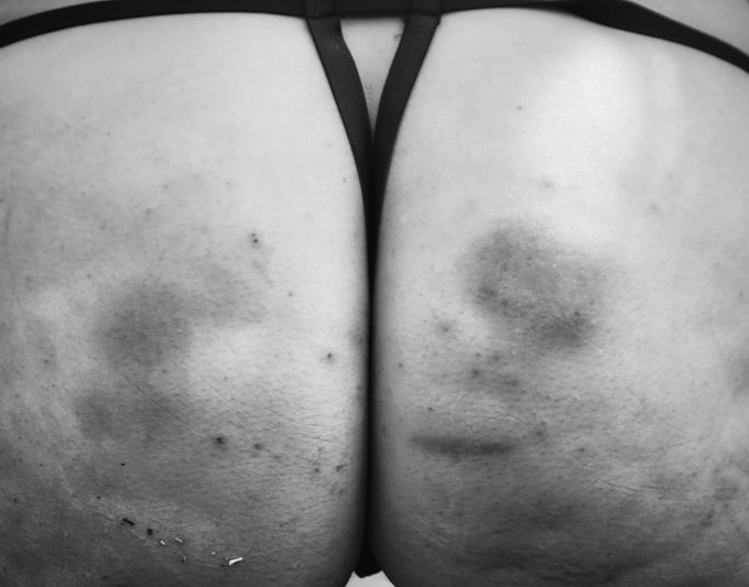 Got some nice ass marks from my last outing!  New video coming soon so you can see how I got them 😉 https://t