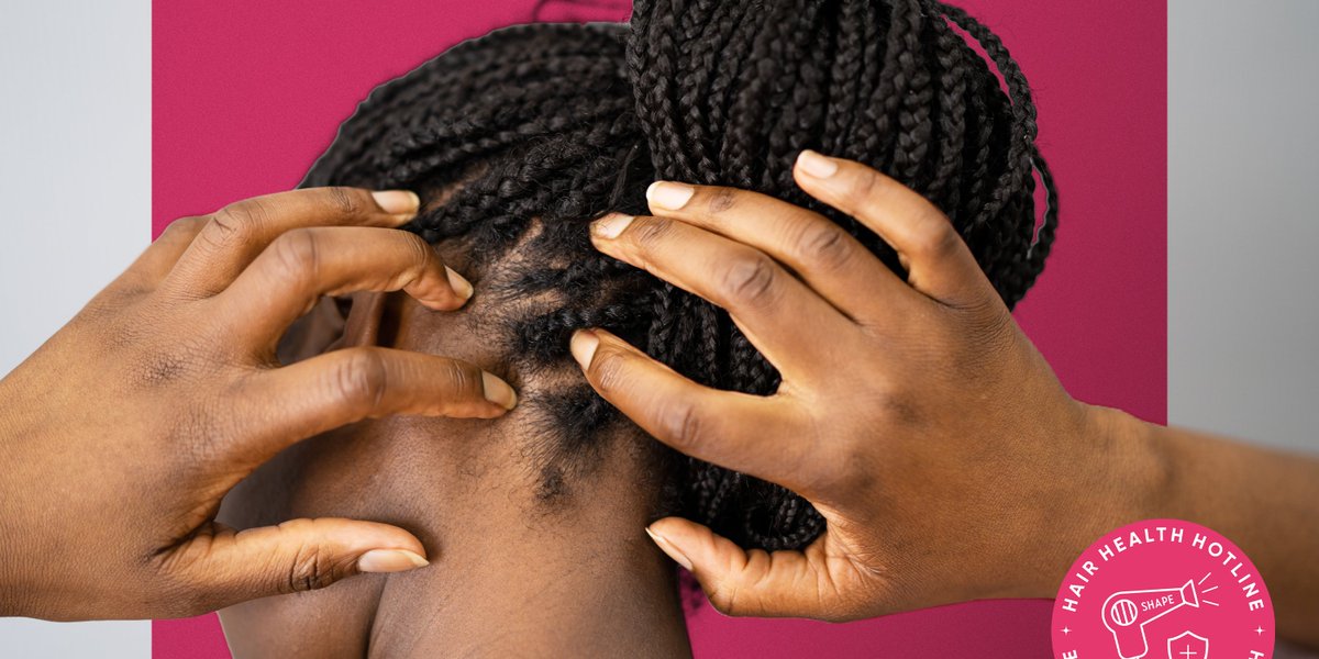 Best Dry, Itchy Scalp Solutions, According to a Trichologist | Shape - Shape Magazine dlvr.it/SRWVp9