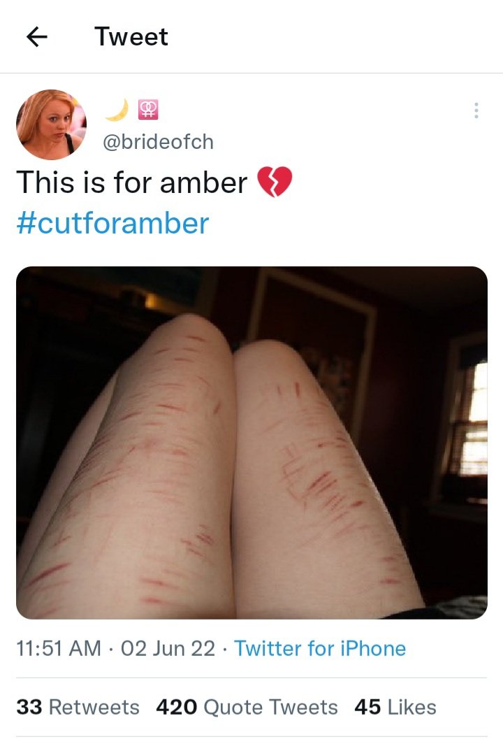 Mitchel43958009's tweet photo. Crazy bitches will do ANYTHING for attention..⬇️ #cutforamber https://t.co/d7iF3xeGa2
