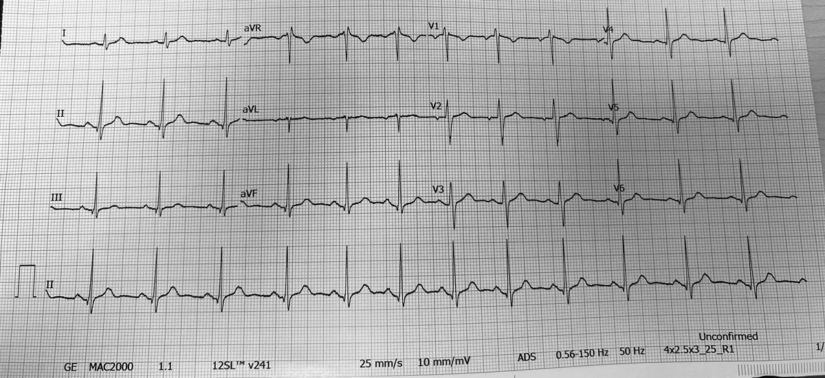 Zachary Hale tweet media