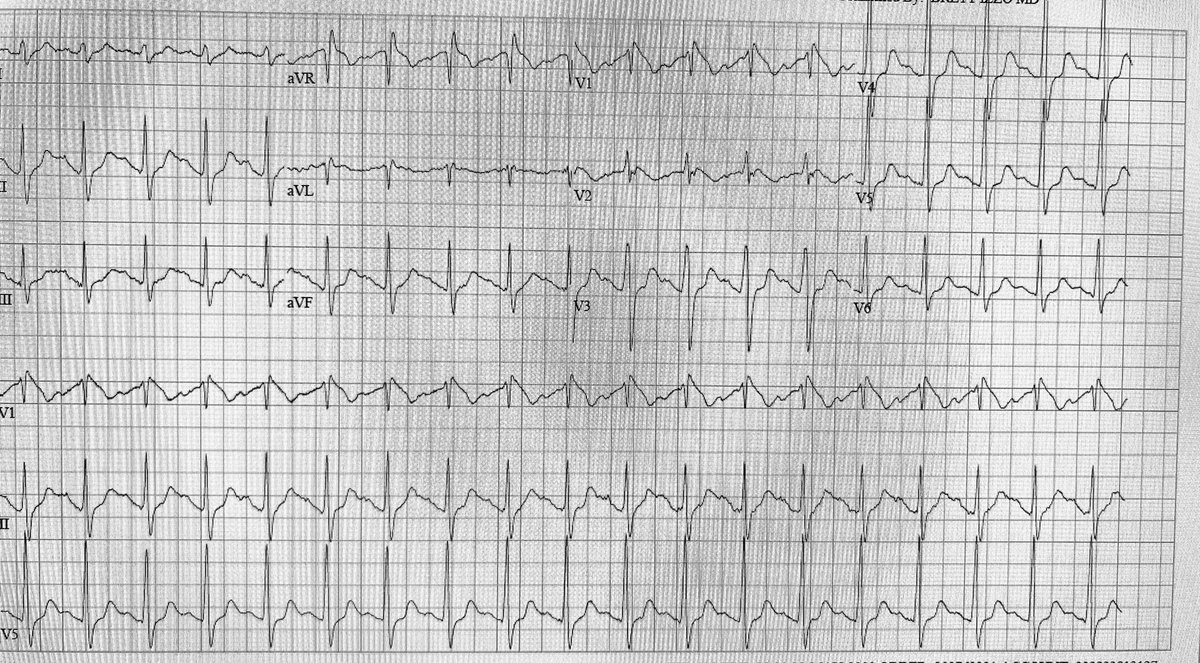 Zachary Hale tweet media