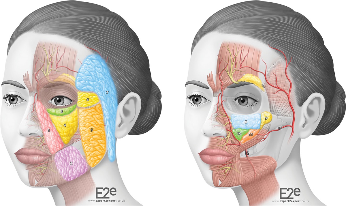 Trending in PRS: Midface Multilayering Filler Injection Technique
