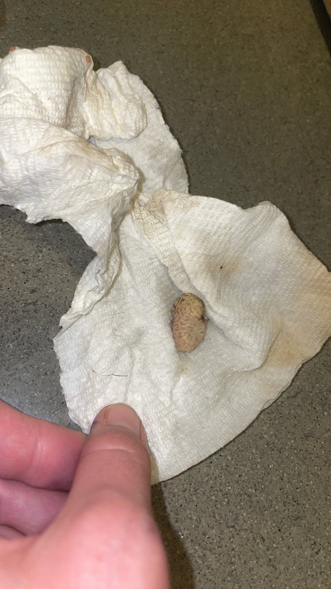 lilyhotels's tweet photo. @LoblawsON you should really put warnings on your rotisserie chickens if the brain is gonna be included 🤢 https://t.co/iQUf5zCekf