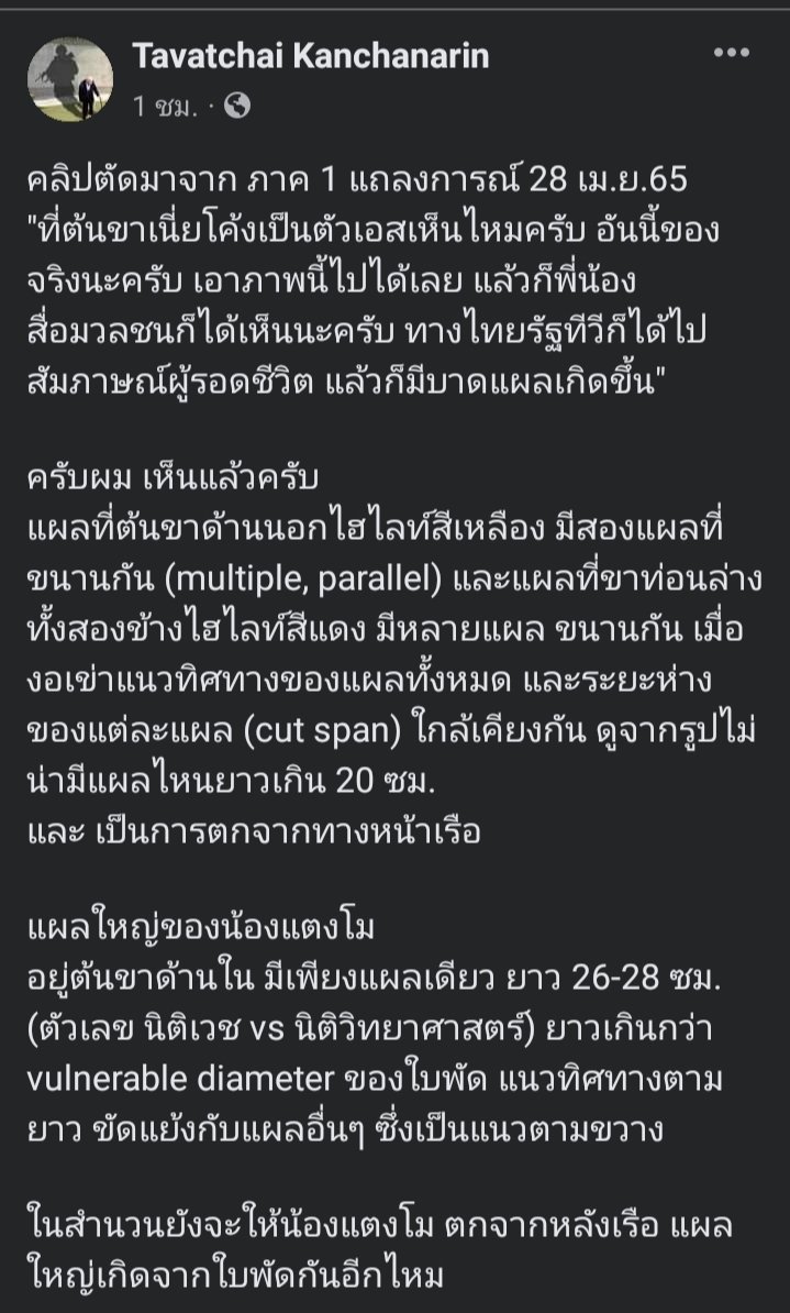 SmithJT16's tweet photo. แผลใหญ่ที่ขาแตงโม
มีขนาดยาวกว่าใบพัดเรือ
แต่ก็ดันทุรังให้ตกท้ายเรือ
กราบขอบพระคุณอาจารย์หมอครับ
🙏🙏🙏
#แตงโมต้องได้รับความยุติธรรม
#Saveเต้007
#Saveอัจฉริยะ https://t.co/HzYRbFyttf