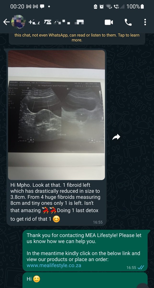 Seededhb's tweet photo. FIBROIDS, now you see them NOW YOU DONT. It's always a celebration at MEA Lifestyle. 

If this dont make some pick up the phone and say Mpho I'd like to consult about making atleast 50% change to my lifestyle, then I don't know. 

Food can be your enemy or your ally. 

#FIBROIDS https://t.co/MUhc2hN3Jm