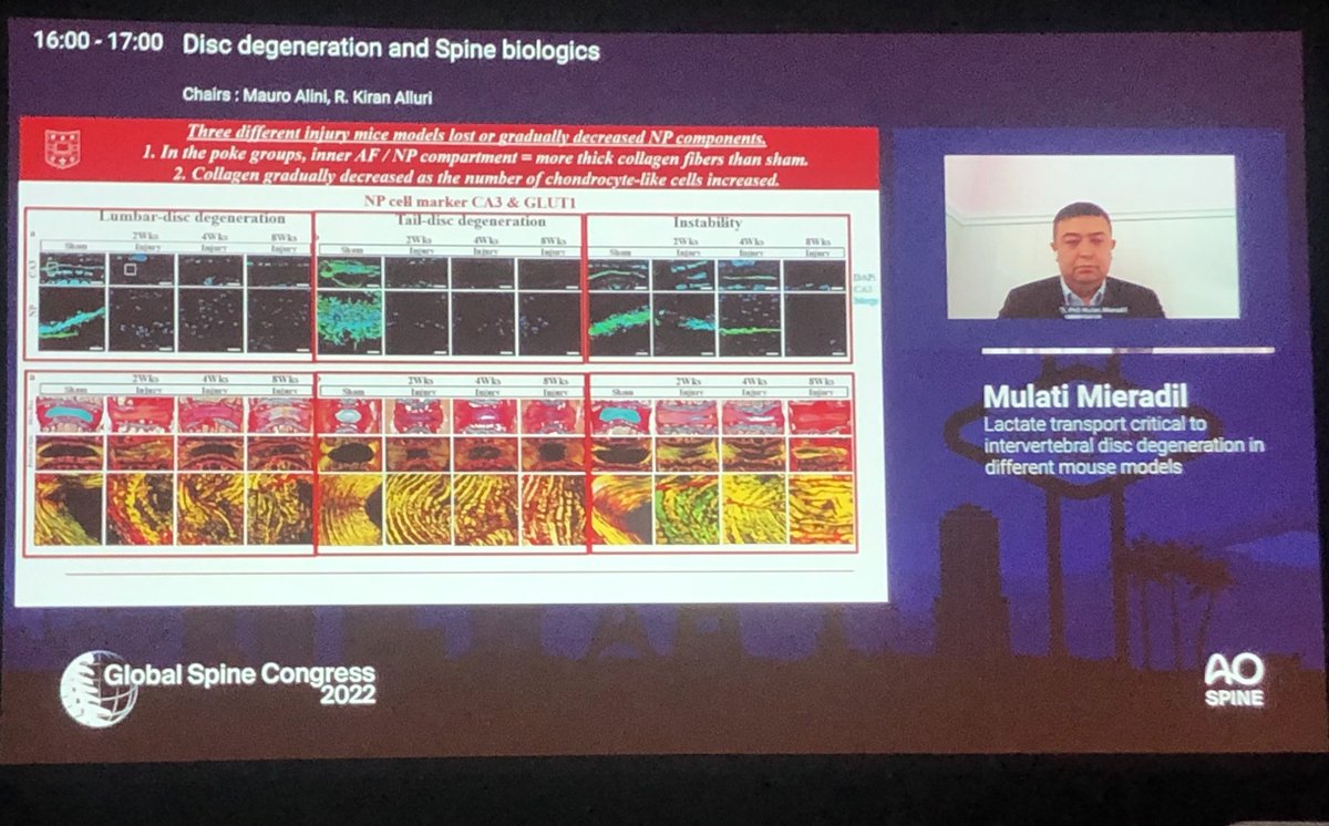 Honored to fill in for Dan Sciubba this morning for opening remarks at Global Spine Congress. A fantastic meeting that already has included a talk from my postdoc, with a talk from my PhD student coming up! @WUSTLortho @GoodwinTumorLab #GSC2022 @atmghn