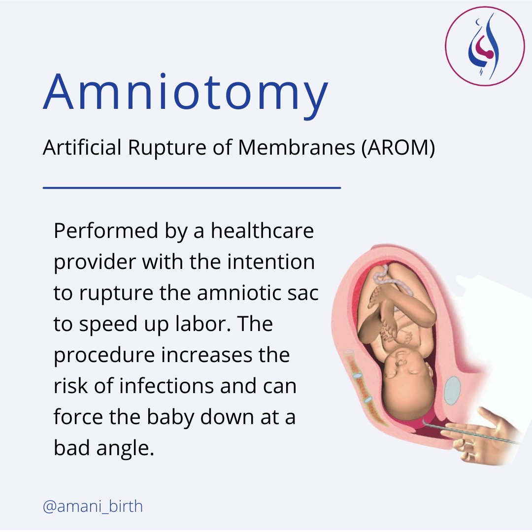 AMANI_Birth's tweet photo. 💡 The American College of Obstetricians & Gynecologists (ACOG) recommends healthcare providers wait longer to perform this procedure in low-risk pregnancies where mother & baby are progressing normally.
#amniotomy #lbirth #memebranesweep #medicalintervention #memebranerupture https://t.co/FLhGfGaXXU