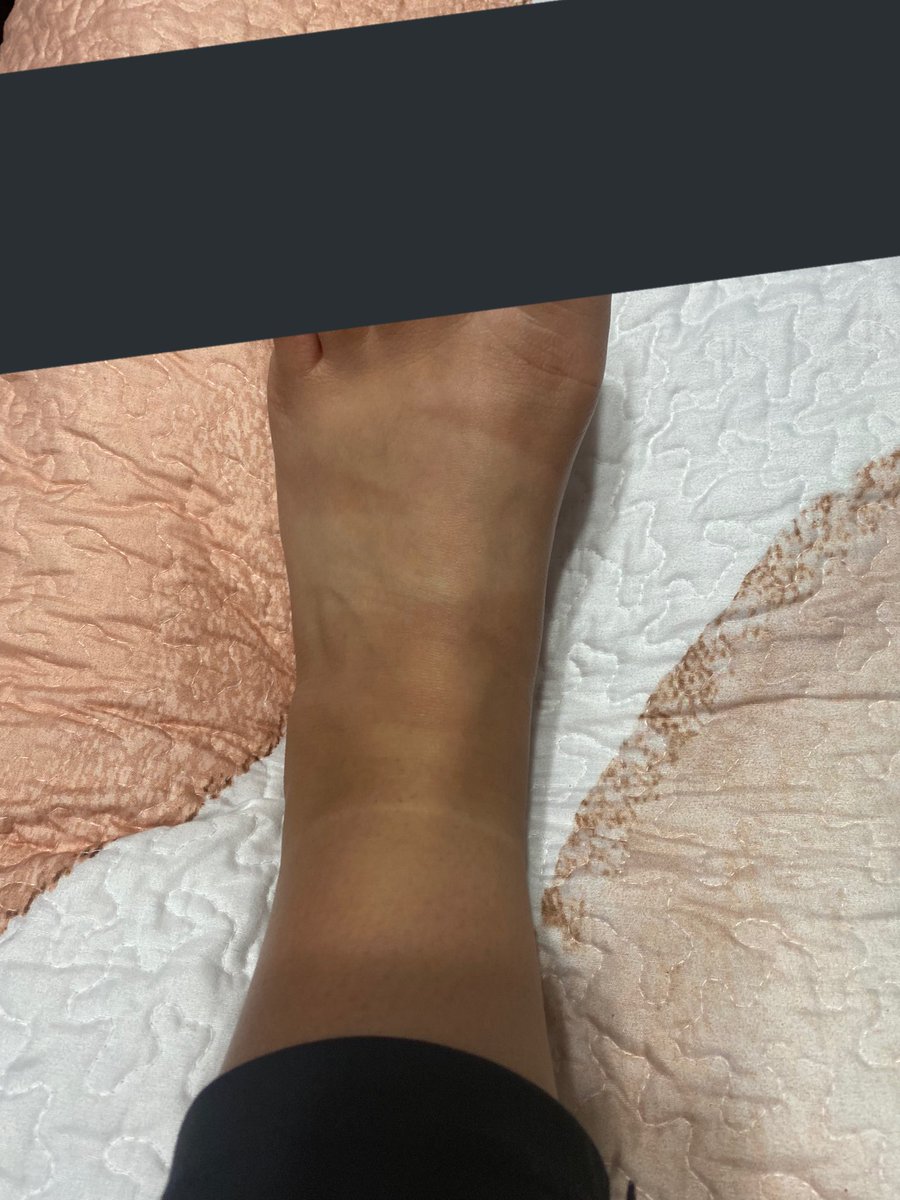 Wreckiniall_'s tweet photo. I was outside for about 3 seconds and got a chacos and anklet tan  🙃 https://t.co/M4NiZpoRr1