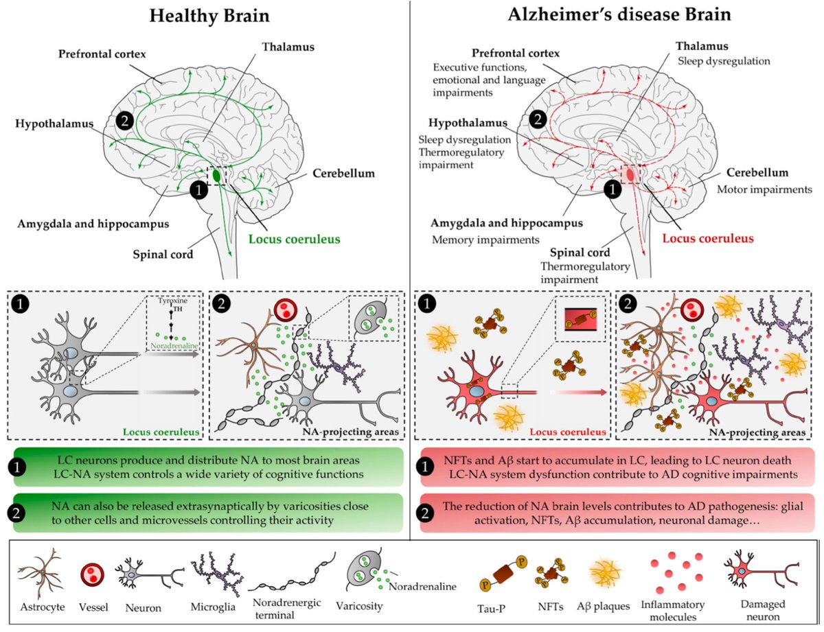 MTJBetts's tweet photo. Noradrenaline in Alzheimer’s Disease: A New Potential Therapeutic Target
https://t.co/ZiIZ5KkXQ7 https://t.co/hWpqsLPlf8