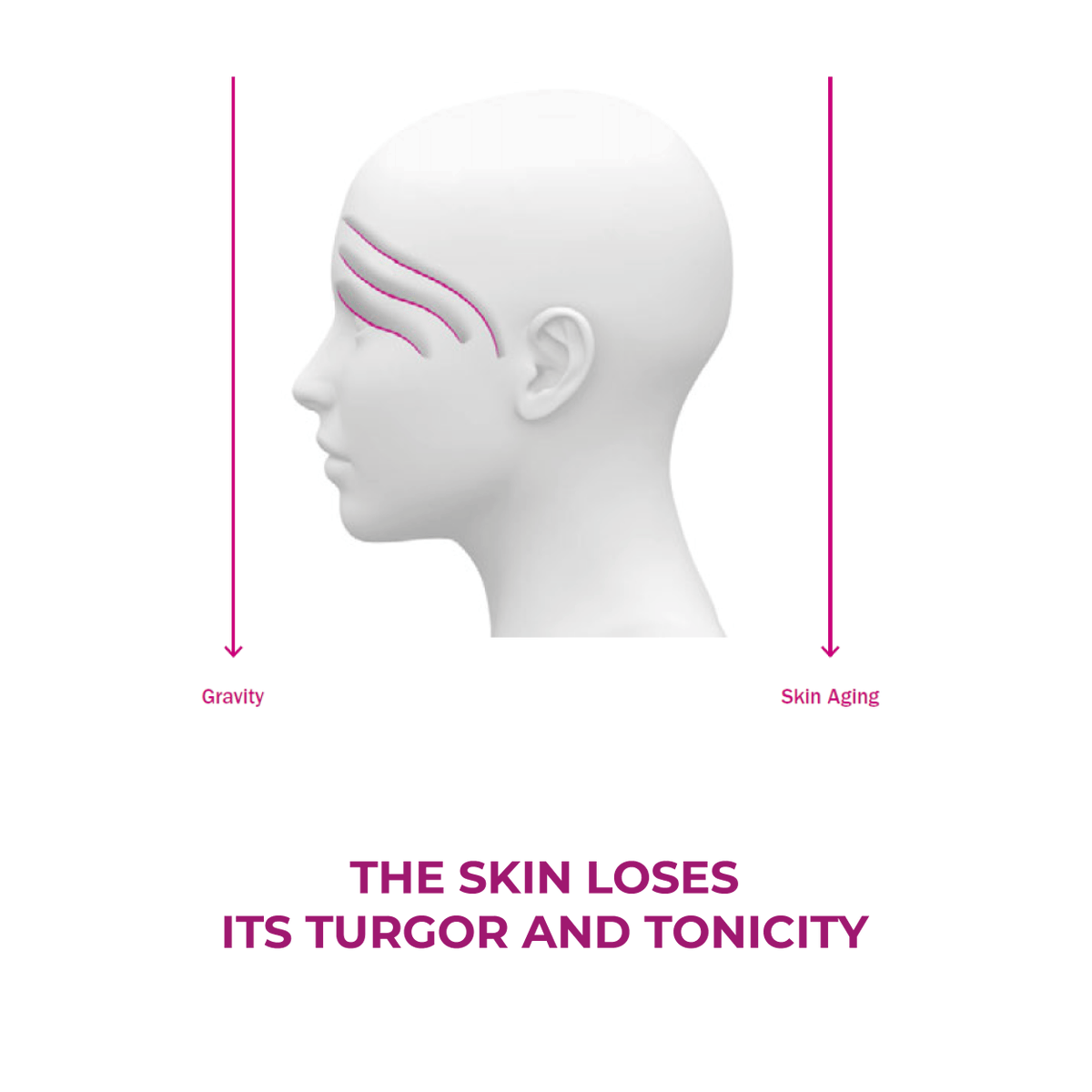 Over the years the effect of gravity starts affecting the skin. The Facial and Eyelid Treatments act exactly on the skin laxity and on the marked reduction of the sagging signs of the facial features. labosuisse.com
#faciallifting #eyelidlifting #labosuisse