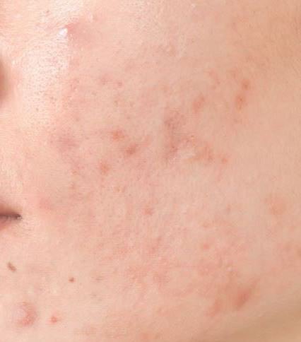 RacunLocal's tweet photo. Top Rekomendasi Skincare Cowok Buat Ilangin Komedo &amp; Bekas Jerawat ✨

⤵️A Thread ⤵️ https://t.co/hmEcGhjmBL