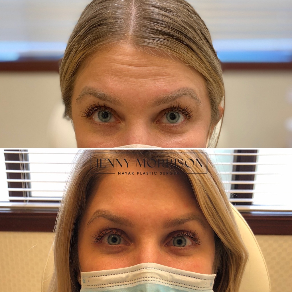 Nayak Plastic Surgery & Avani Derm Spa tweet media