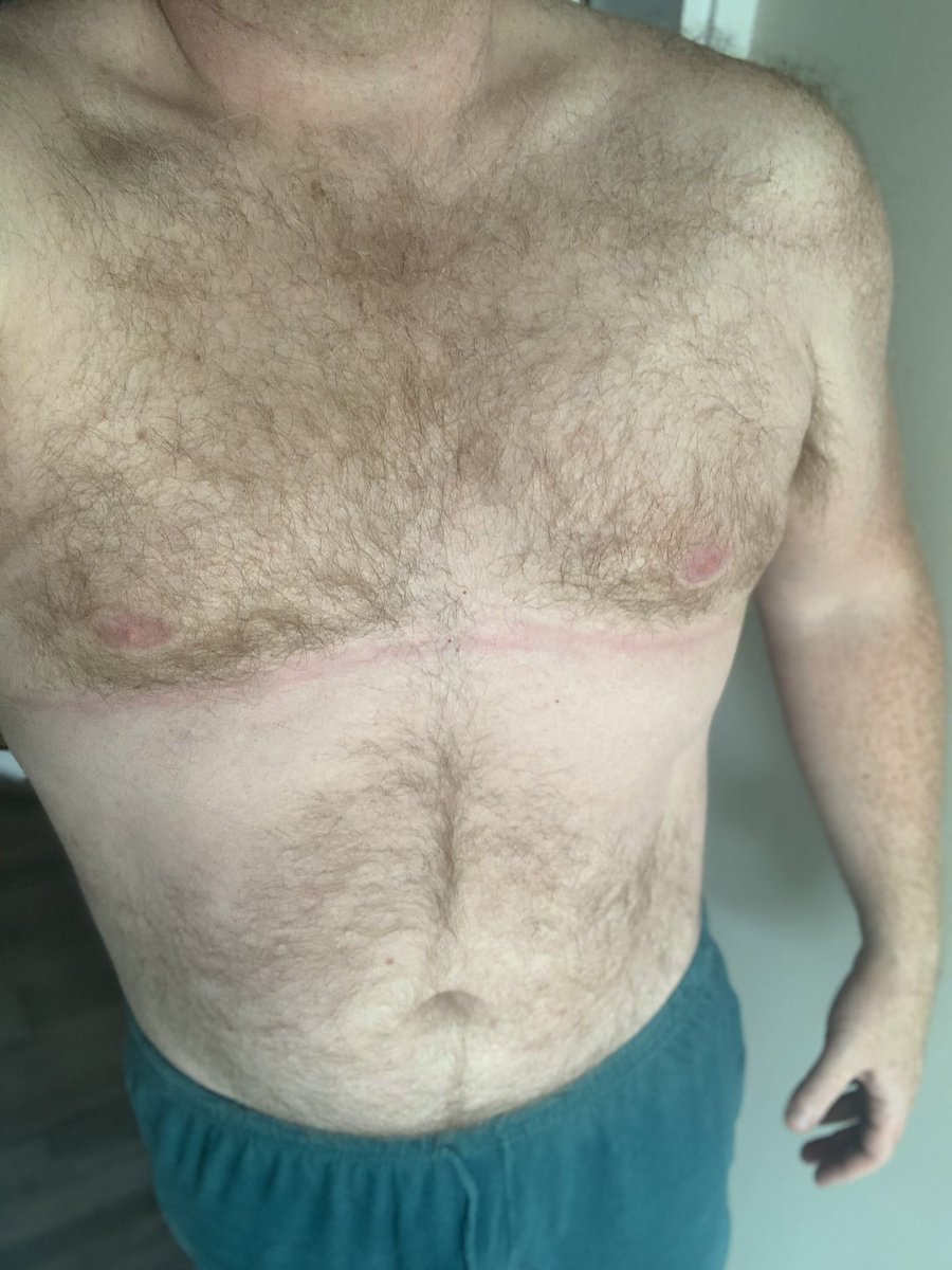 GayGingerGeek1's tweet photo. I’m here to celebrate body positivity, however you look! Hello twitter! #gay #ginger https://t.co/fqgH1Q3CkO