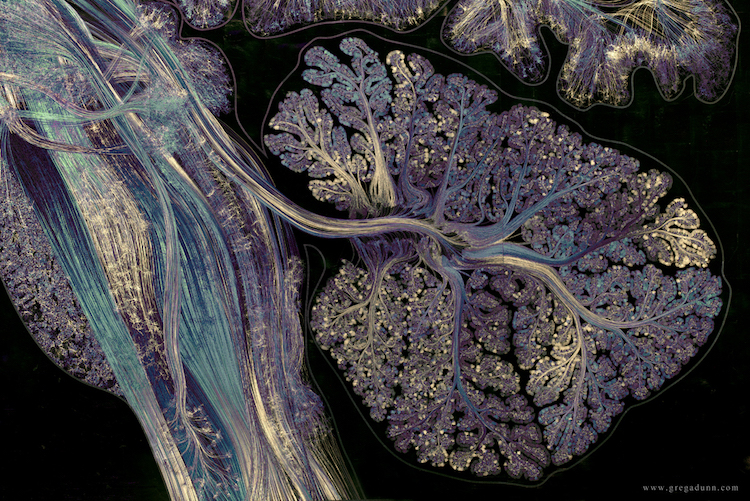 slava__bobrov's tweet photo. Cerebellum contains over 50% of the total number of neurons in the brain:

#neuroscience by G. Dunn https://t.co/1xI7KIUybL
