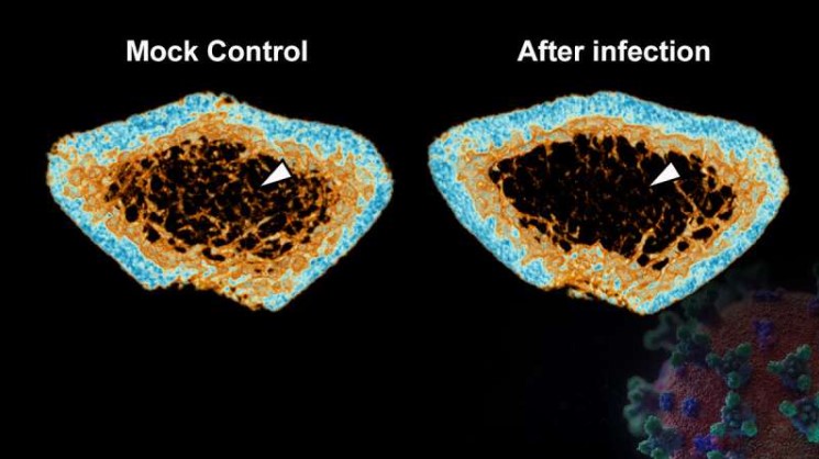 ASBMR's tweet photo. SARS-CoV-2 infection induces severe inflammatory bone loss in Syrian hamsters #ASBMR #BoneScienceNews

https://t.co/BYdzgZ2nxX https://t.co/dMb6mue8HU
