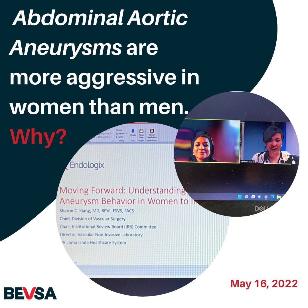 _bevsa's tweet photo. BEVSA's own Dr. Sonya Noor joined Dr. Sharon Kang to discuss abdominal aortic aneurysms (AAA) in female patients during a webinar entitled "United We Conquer--Best practices of Overcoming AAA Challenges in Female Patients, Presented by Female Surgeons" hosted by Endologix. 1/ https://t.co/mYz7MjFg7F