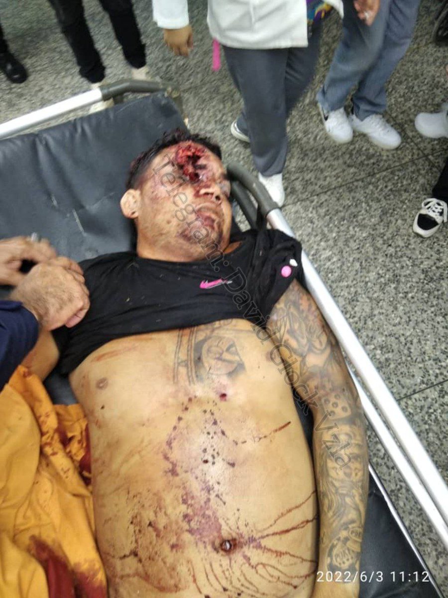 Birrilly's tweet photo. (((ASÍ QUEDÓ))) Vía #DavidGlock #Miranda Comisión del #CCP #OcumareDelTuy fue atacada por miembros de la banda de #CarlosCapa, en el hecho murió alias #ElJacksito, se recuperó un fusil #AK103 de la #GNB @ReporteYa @CronicaPolicial @RPolicial @policiactiva @JalabolasRojo @NTN24 https://t.co/AeZvmFBZnU