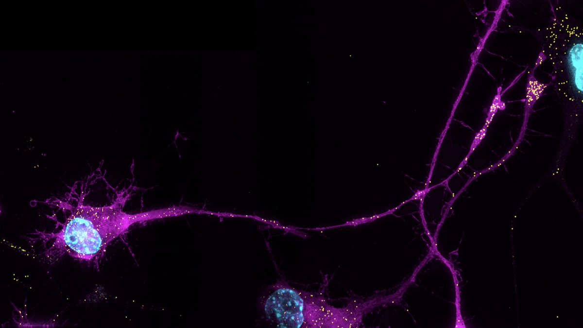 arorankita's tweet image. RNA peeps at @RNASociety meeting #RNA2022 come visit me today evening at my poster PS3-399 and nerd with me about RNA Zipcodes and #RNALocalization. We used an unbiased Massively Parallel Reporter Assay for identifying novel zipcodes in neuronal cells.