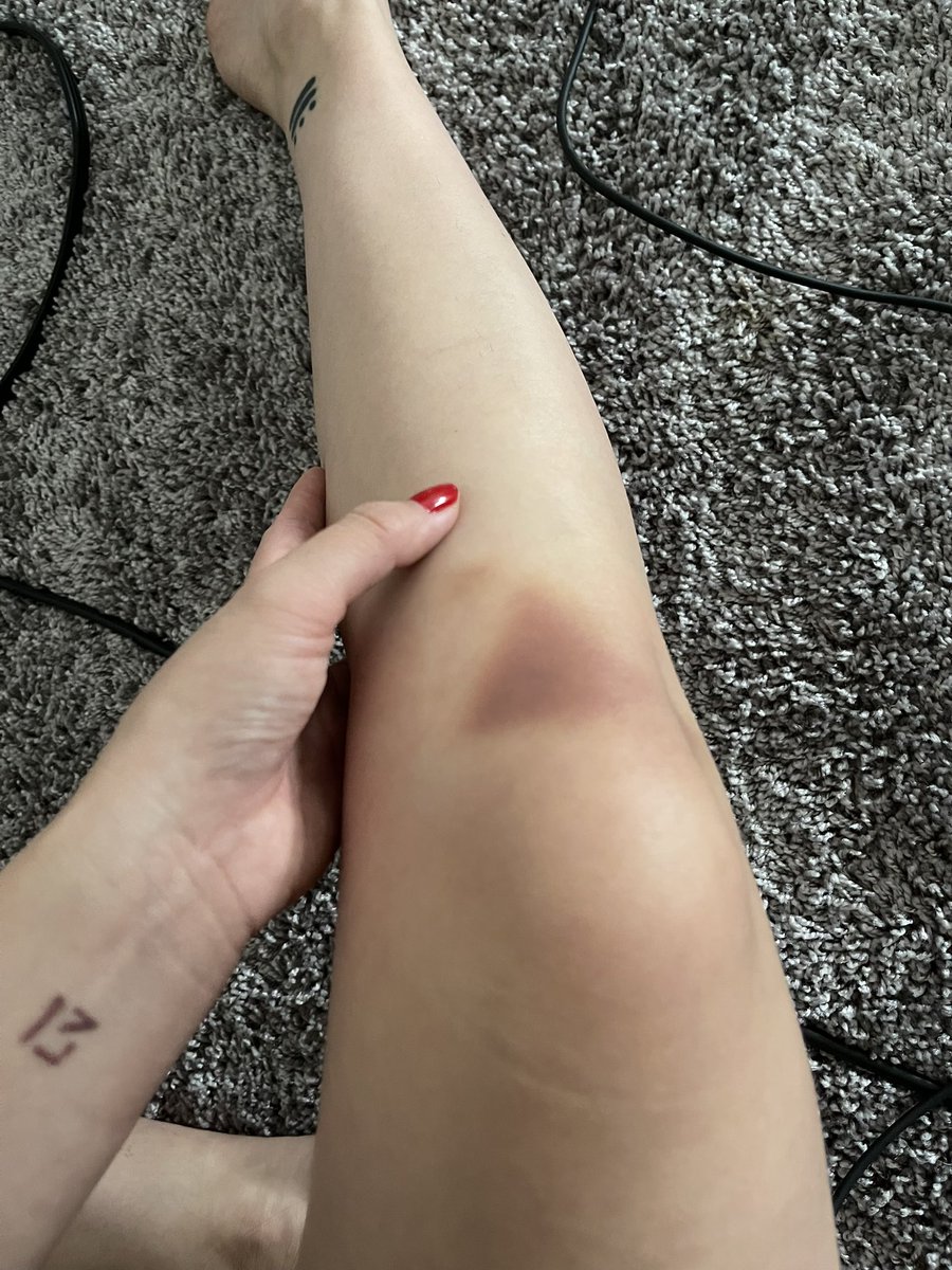 I fell HARD the other day

Like… I have not fallen that hard since grade school (or my first crush 😜)

And why is it a triangle?

I’ll just say a gate was involved.

#NFTCommunity