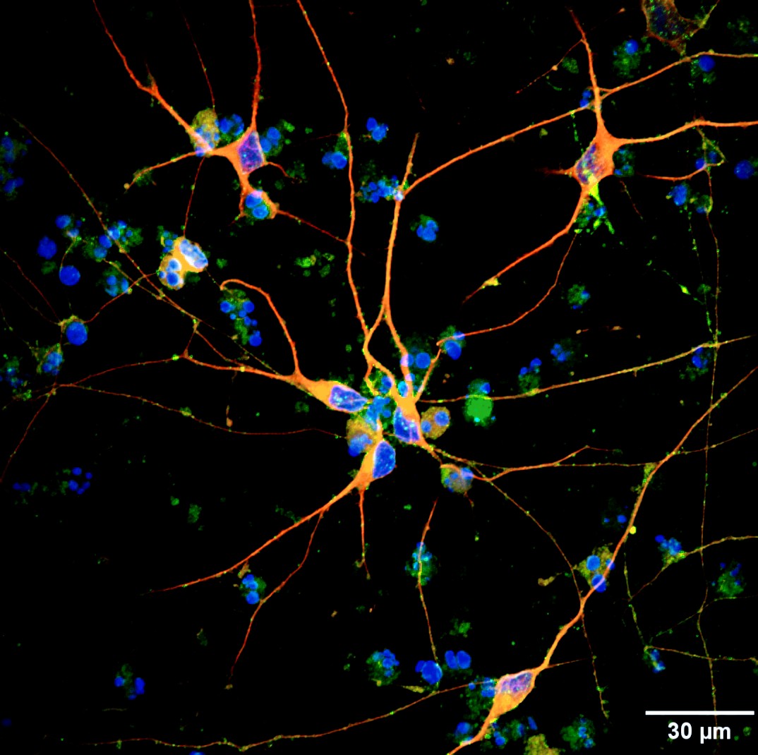 For #FluorescentFriday, few things are more satisfying than an old classic IF performed on nicely differentiated #neurons 😍🧠🔬
#SciArt #phdlife #neuroscience
