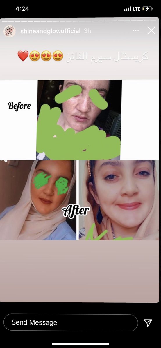 shineandglowcos's tweet photo. سحب على كريستال بكج كامل🔥

كريم و سيرم كريستال، تونر و كريم مرطب😍

لانهم مكملات لبعض💎❤️

يعني روتين كااامل لبشرتك💎❤️

اسم كريستال ما جا من فراغ💎❤️

الشروط:
فلو، لايك، ريتويت و ختو لينا 💎💎💎 في كومنت،، الحنرد عليها ب 💎💎💎 هي الفايزة معانا

السحب من الكومنتات

0962746892 https://t.co/P1ax0jCZMu