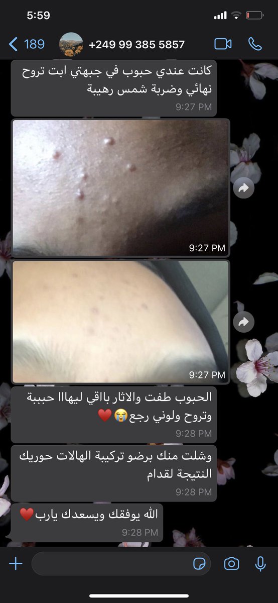 shineandglowcos's tweet photo. سحب على كريستال بكج كامل🔥

كريم و سيرم كريستال، تونر و كريم مرطب😍

لانهم مكملات لبعض💎❤️

يعني روتين كااامل لبشرتك💎❤️

اسم كريستال ما جا من فراغ💎❤️

الشروط:
فلو، لايك، ريتويت و ختو لينا 💎💎💎 في كومنت،، الحنرد عليها ب 💎💎💎 هي الفايزة معانا

السحب من الكومنتات

0962746892 https://t.co/P1ax0jCZMu