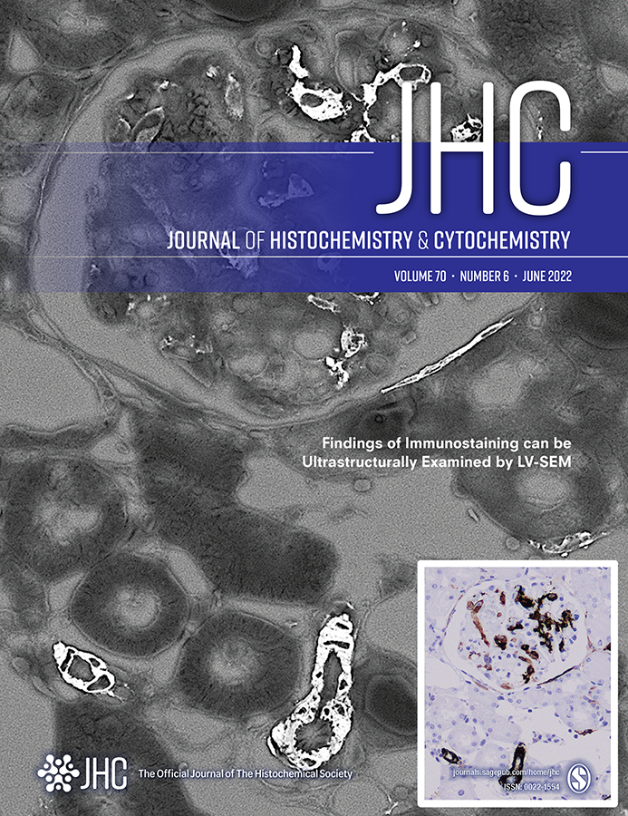 histochemnews's tweet photo. The new June 2022 issue of @JHCnews is now available online!
Check out the latest articles at https://t.co/dqol9tvjkl
#Science #Histochemistry #Cytochemistry https://t.co/yCXifDONaj