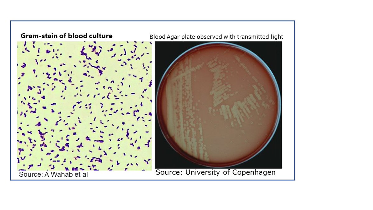 In r  'FINDINGFRIDAY' 'MysteriousMicrobe'series, guess which bacteria it is frm the Gramstain&hemolysis on blood agar plate below. The clue is 'Bluebell creameries' @DukeMGM @MicrobioSoc @medtechlyfe @JClinMicro @cellhostmicrobe @MicrobiomDigest @JBacteriology #mysteriousmicrobe