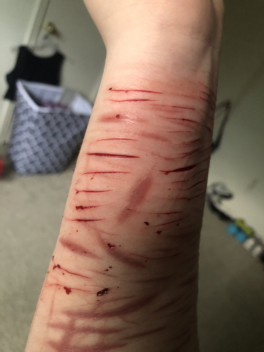 sillykitty92's tweet photo. Cleaned

*NOT REAL , FAKE , SFX, CGI, THIS PHOTO IS FICTION, FAKE BODY, MAKEUP *
-
shtwt , barcodetwt , catscratchtwt , styrotwt , ouchietwt , armgillstwt , sliceytwt , raspberryfillingtwt , redbreadtwt https://t.co/KCI6z7l8yM