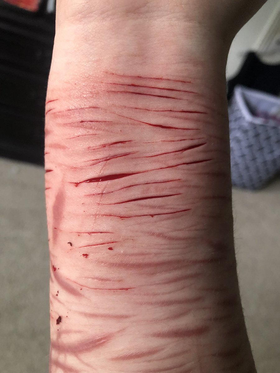 sillykitty92's tweet photo. Cleaned

*NOT REAL , FAKE , SFX, CGI, THIS PHOTO IS FICTION, FAKE BODY, MAKEUP *
-
shtwt , barcodetwt , catscratchtwt , styrotwt , ouchietwt , armgillstwt , sliceytwt , raspberryfillingtwt , redbreadtwt https://t.co/KCI6z7l8yM