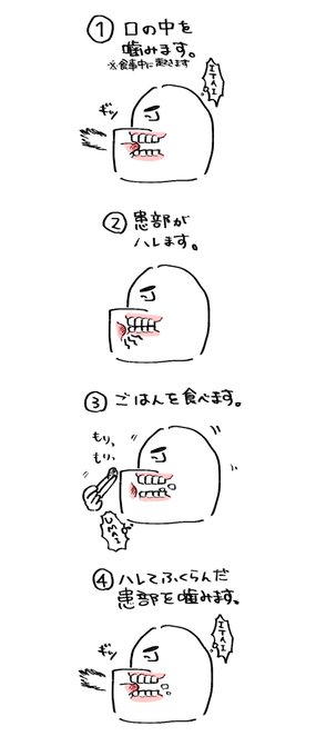 一回の食事でこれ5回くらいやるから口の中の怪我大体治るの遅い 