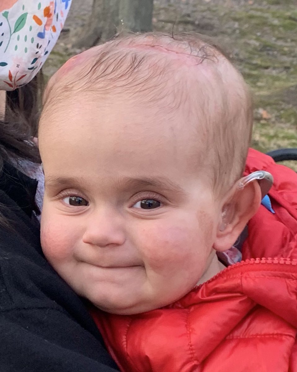 TeamBeansFund's tweet photo. https://t.co/A30XrQa9F5 so we can make sure less kids have cancer scars. https://t.co/pqNhbdugYi