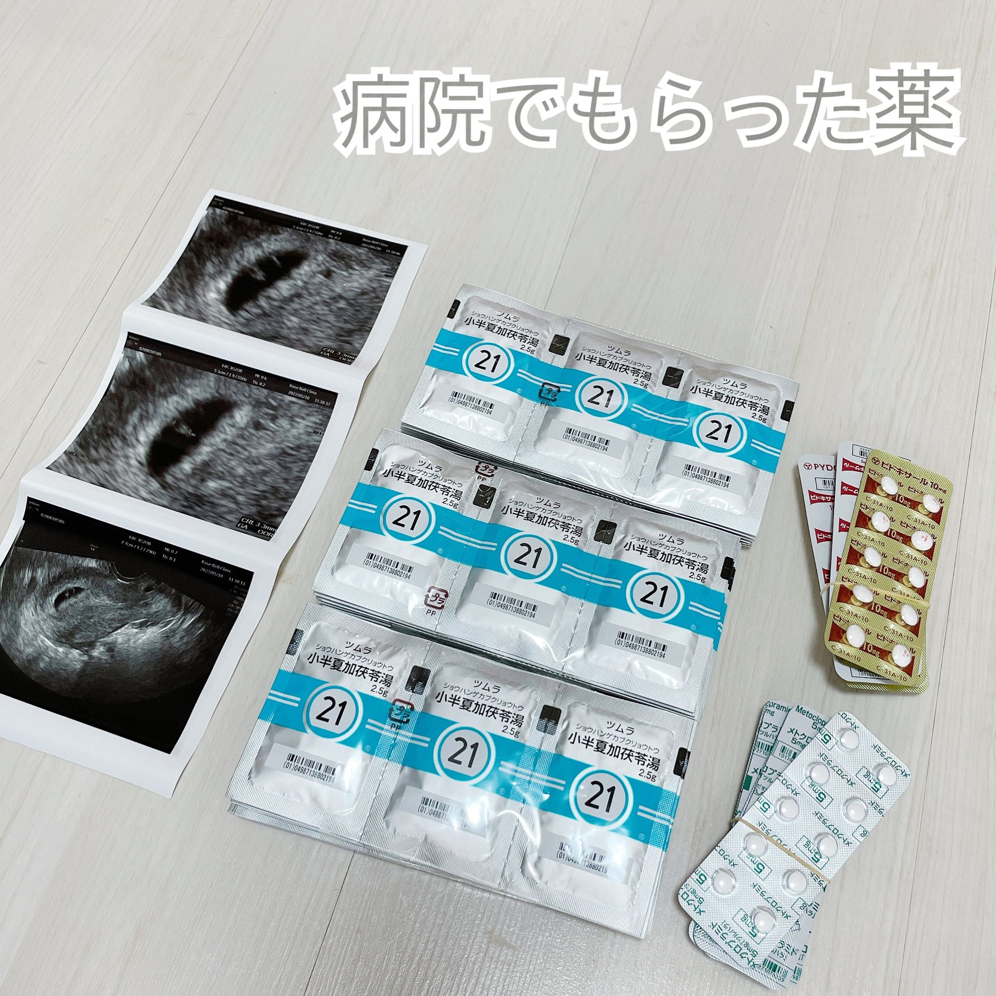 れもん 4y 2y 0m 3兄弟ママ 病院でもらった薬を飲むと 1時間くらいだけ吐き気が落ち着く気がします またすぐ気持ち悪くなるけど 小半夏加茯苓湯 つわりに効くらしい漢方 メトクロプラミド 吐き気止め ピドキサール ビタミンb6 T Co れもん 4y 2y 0m 3兄弟ママ 病院でもらった薬を飲むと 1時間くらいだけ吐き気が落ち着く気がします またすぐ気持ち悪くなるけど 小半夏加茯苓湯 つわりに効くらしい漢方 メトクロプラミド 吐き気止め ピドキサール ビタミンb6 T Co