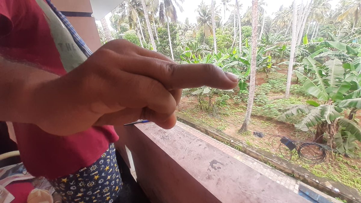 ashwinrajenesh's tweet photo. A short 🧵.
To remind you to not stick your finger in trouble.

Image 1/5:
Typical spotter in the OSCE for medical students. https://t.co/Wu98FGfwc2