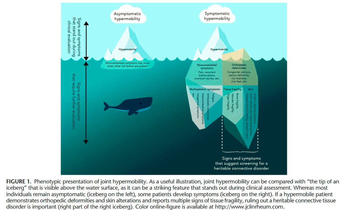 International Perspectives on Joint Hypermobility

A Synthesis of Current Science to Guide Clinical and Research Directions

👀👀👇👇

journals.lww.com/jclinrheum/Ful…