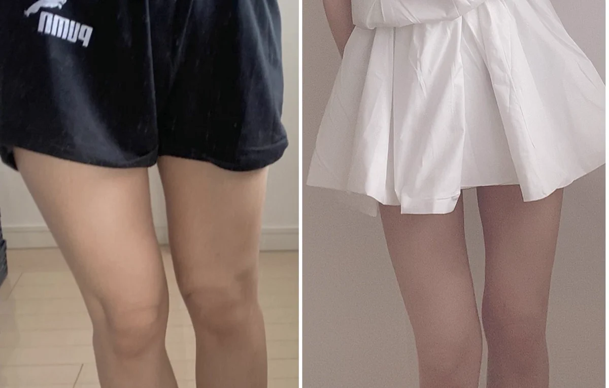 これで下半身すっきり♡股関節をほぐして行うトレーニングで最高の下半身を手に入れる方法