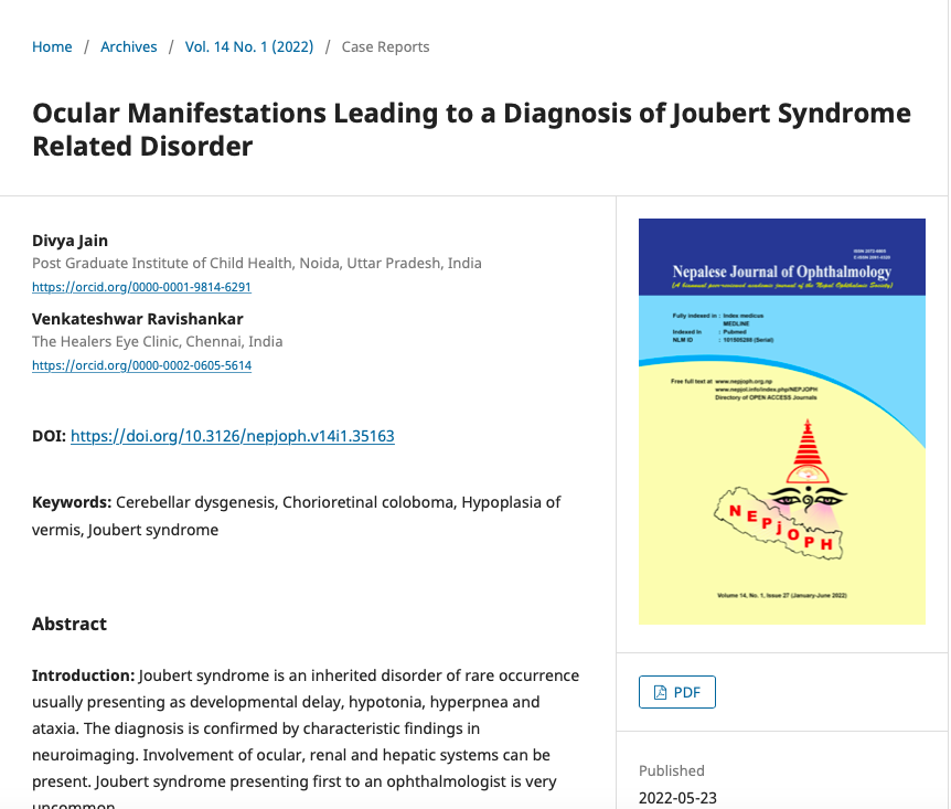 Happy to share my publication on Joubert syndrome