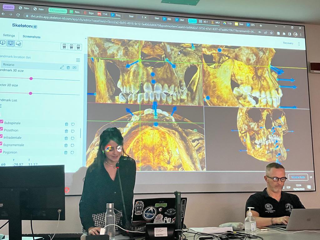 emilionuzzolese's tweet photo. 3 days of #DVI training course 2022 with hands-on session: autopsies on cadavers, #Anatomage Table, #skeletonId. 8-9-10 June 2022 @unito

With Sven Benthaus, Corrado Calì, Rosario Guerra and me.
Intense work for a multiagency involvement in human #identification

#ETAF
#Interpol https://t.co/9D4DtenBrl
