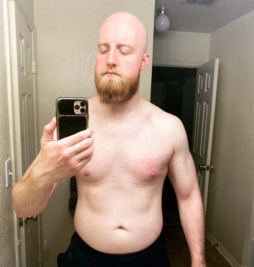Dyl_Fa_Ryl's tweet photo. Pic 1: Before Hell
Pic 2: The scars earned from coming back 

Chilly Boys on top 🤙🏻

#prowrestling #dfwap #whiteclaw #chillyboys #ProWrestlingDallas #wwe #raw #smackdown #njpw #wrestlekingdom #gcw #aew #bigvibe #vibezilla #haltomcity #chillyboysummer #hellandback https://t.co/YDLGnx5SBF