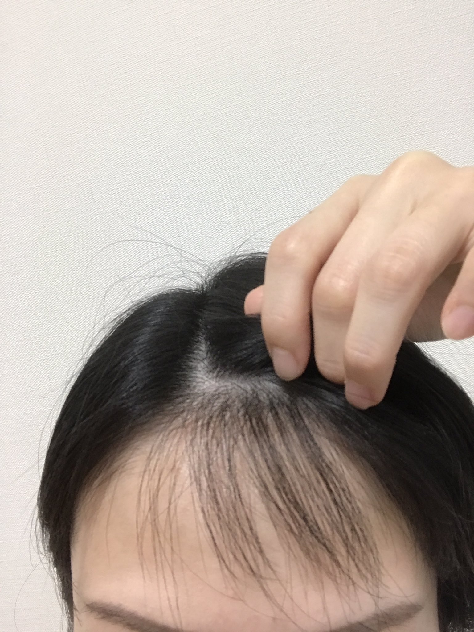 講談師 一龍斎貞鏡 3人目の産後 抜け毛が酷い 一旦抜けた内側の毛がぴょんぴょん生えてき纏まらなかったけど中々美容室へ行く時間もなく 一年以上ぶりに美容室へ 前髪無しが好きだけど 生え揃うまで前髪つくった 産後 抜け毛 T Co 講談師 一龍斎貞鏡 3人目の産後 抜け毛が酷い 一旦抜けた内側の毛がぴょんぴょん生えてき纏まらなかったけど中々美容室へ行く時間もなく 一年以上ぶりに美容室へ 前髪無しが好きだけど 生え揃うまで前髪つくった 産後 抜け毛 T Co
