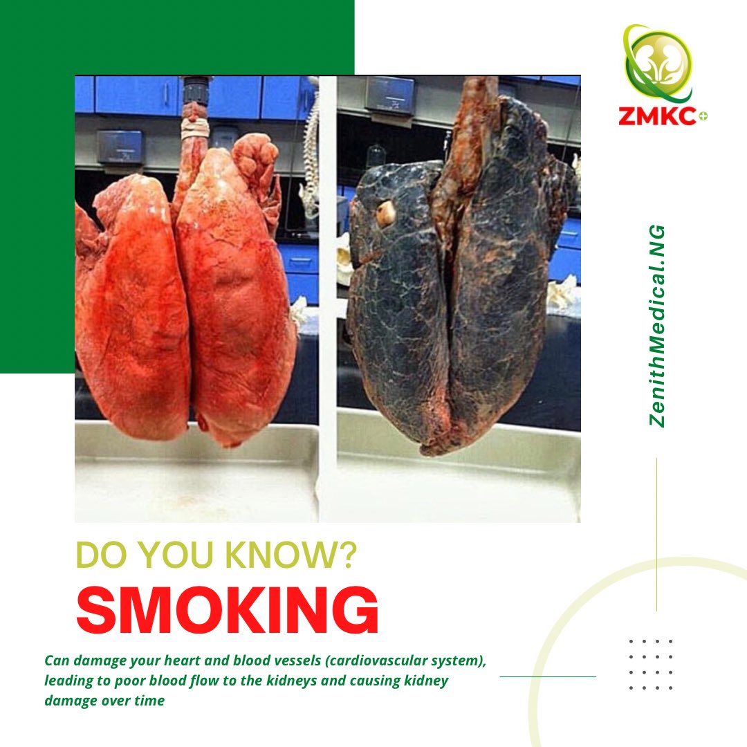 tobacco effects on kidney DO YOU KNOW??? The World Health Organization (WHO) and the have confirmed  that smoking causes harm to almost every organ in the body. The  organizations cite long lists of health problems and