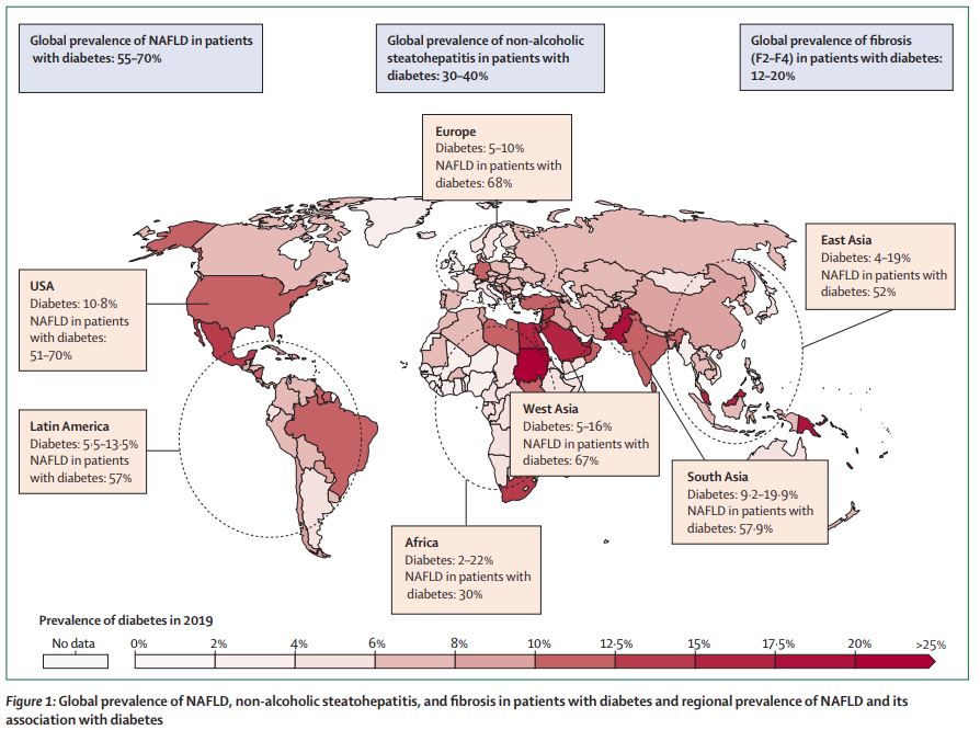TheLancetEndo's tweet photo. A global view of the interplay between non-alcoholic fatty #liver disease and #diabetes https://t.co/YHABg4wt1b #T2D #NAFLD #ADA2022 https://t.co/HftmMN559E